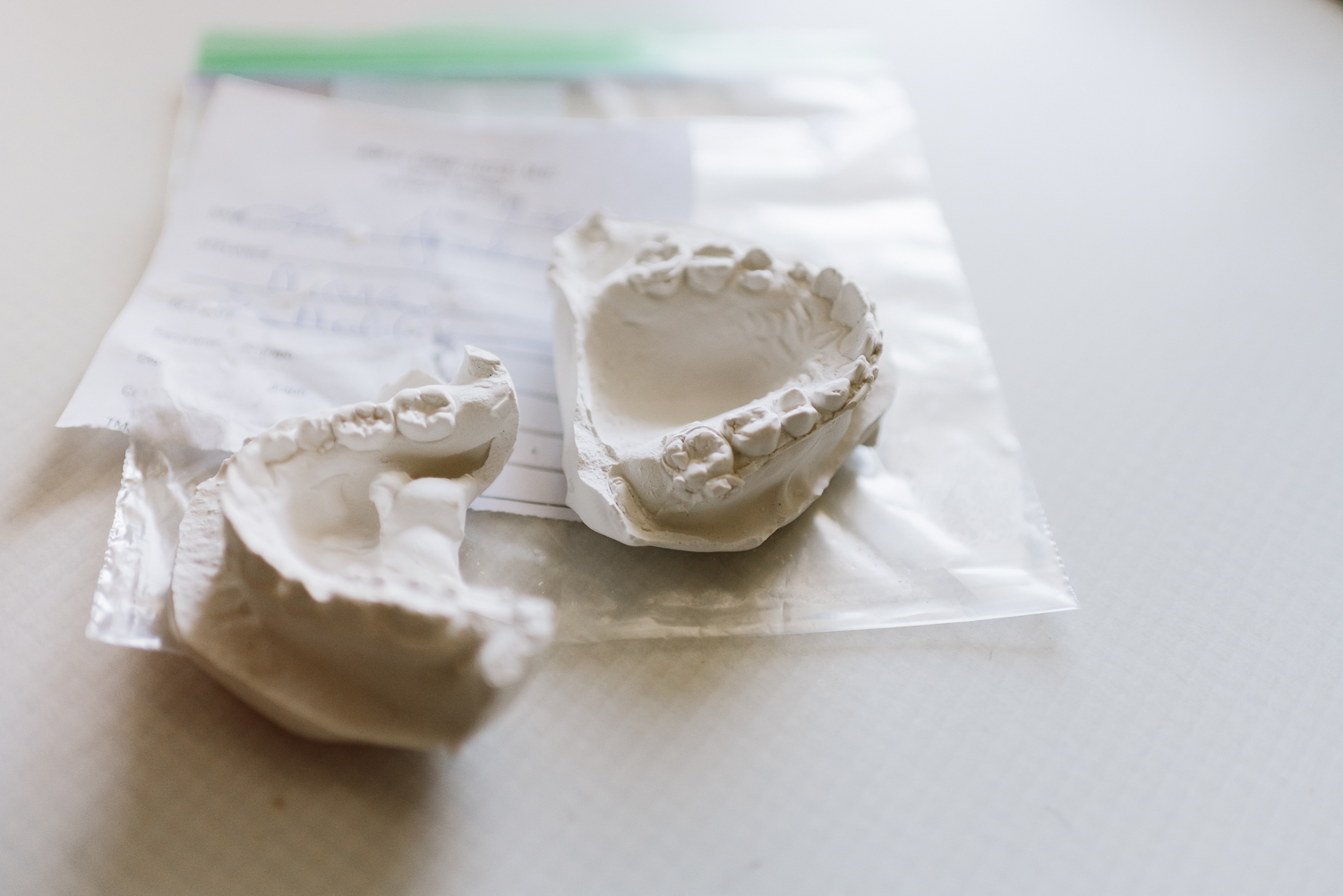Invisalign Mold Invisalign teeth mold