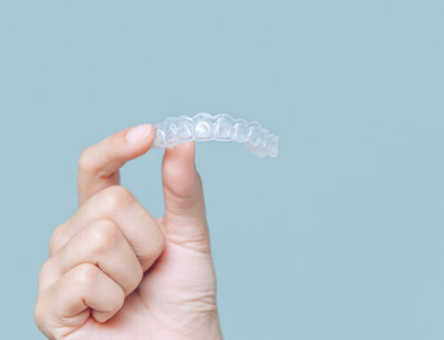 A Guide to Wearing Retainers