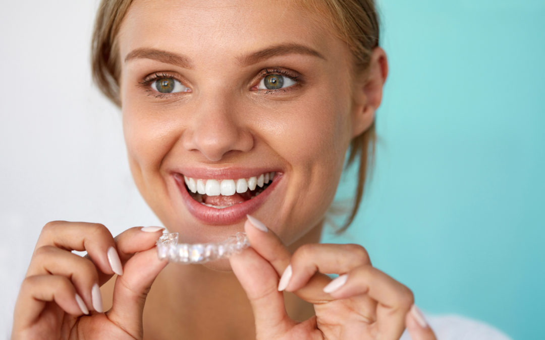 Orthodontics: Braces Versus Invisalign
