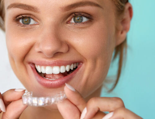 Orthodontics: Braces Versus Invisalign