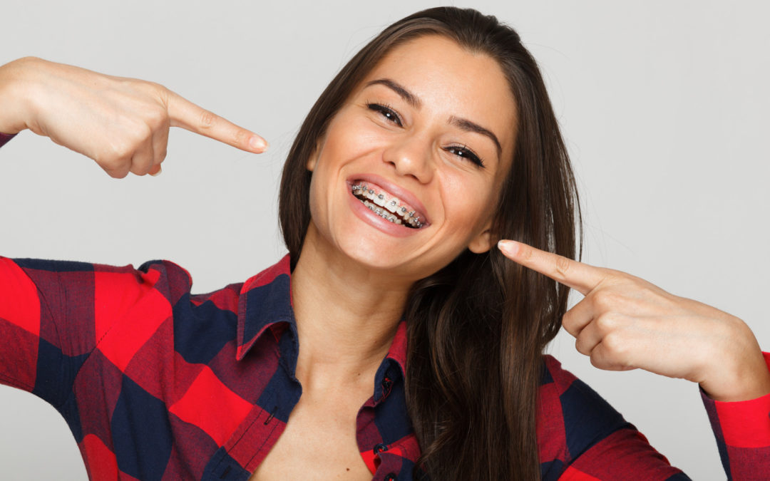 Flash That Smile With Confidence! Here Are Affordable Options for Straightening Teeth