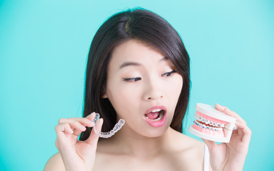 The Complete Guide on How Invisalign Works to Straighten Teeth