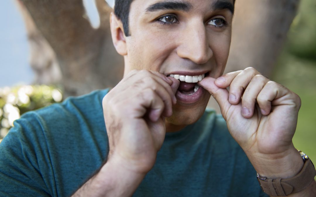 The Complete Guide on How to Clean Invisalign