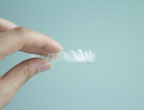 How Much Does Invisalign Cost? The Factors That Determine Your Price
