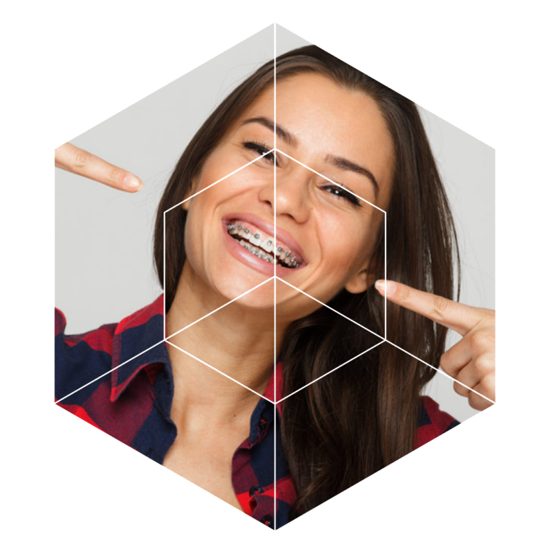 Fort Worth Orthodontist Ahava Orthodontics Invisalign