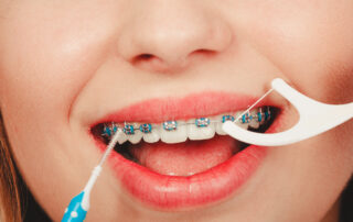 Habits for keeping your mouth and braces clean