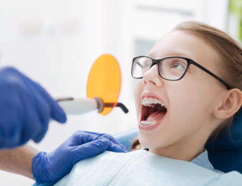 What Is Interceptive Orthodontic Treatment?