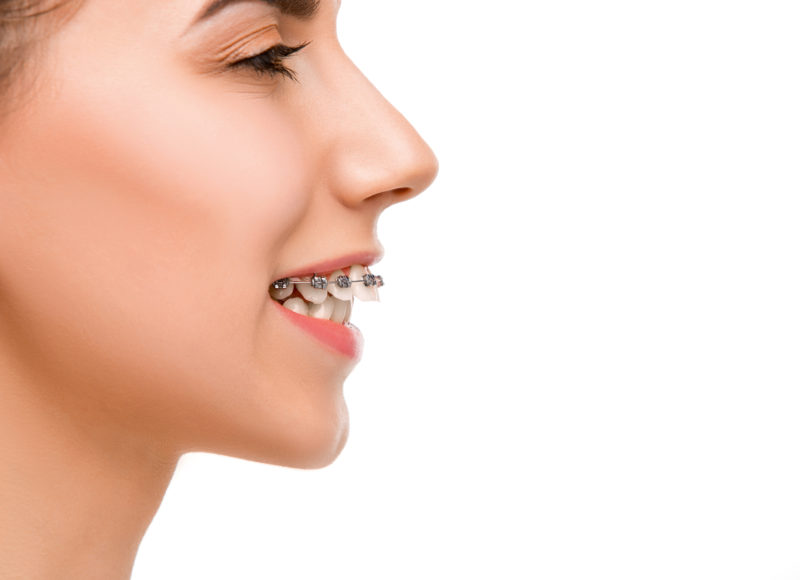 Orthodontic Treatment For Malocclusions Jaw Repositioning Options