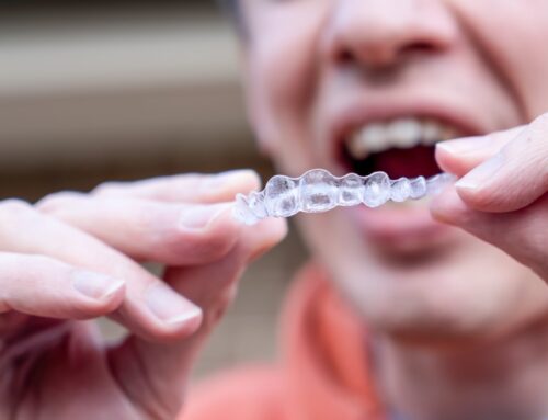 How Does Invisalign Work?