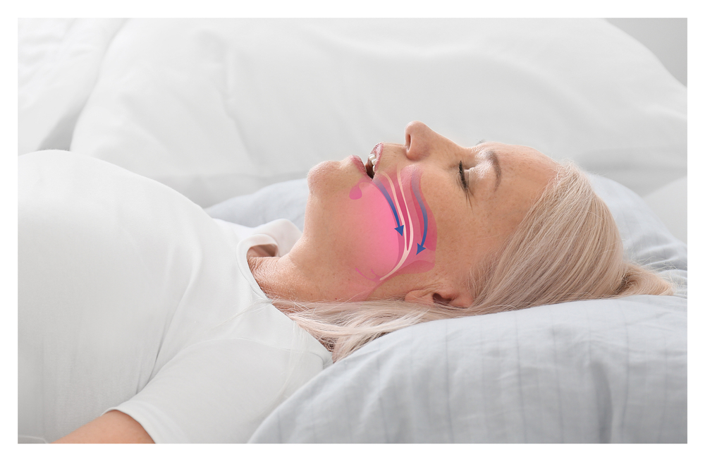 Understanding Sleep Apnea: Causes, Symptoms, and Risks | Ahava Orthodontics