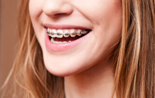 Diagnosing the Need for Braces
