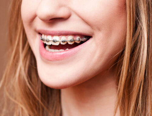 Diagnosing the Need for Braces