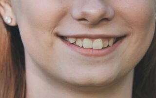 Signs and Symptoms Indicating the Need for Braces