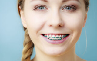 Braces and Aligners for Crowded Teeth