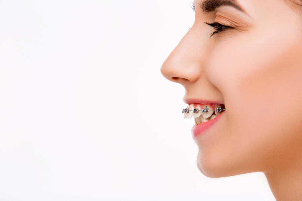 Common Orthodontic Conditions