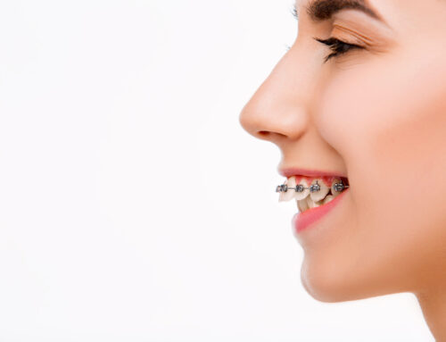 Common Orthodontic Conditions