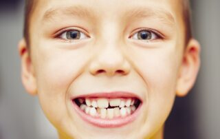 Why Do Teeth Overlap