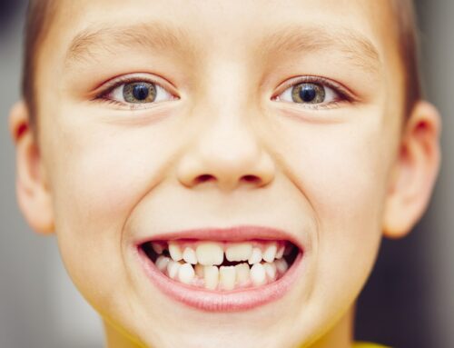 Why Do Teeth Overlap?