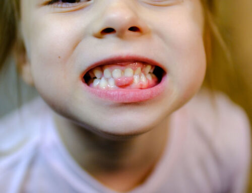 My Child’s Teeth Are Crowding—What Should I Do Next?