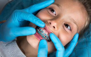 The Real Reasons Your Child Might Need Braces