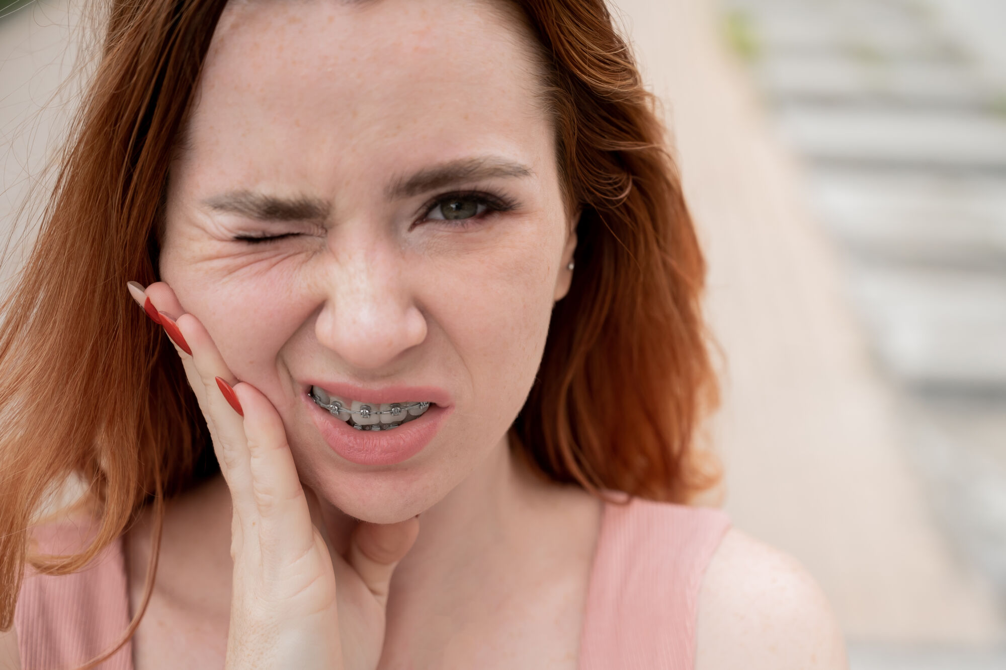 Dealing With Braces Pain at Home Dealing With Braces Pain at Home