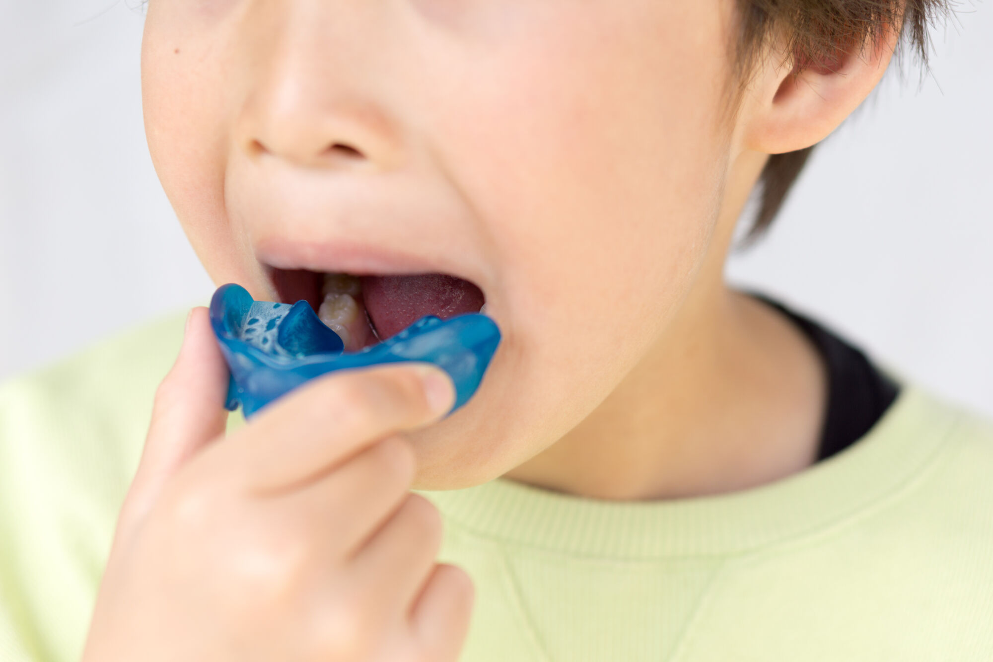 We Can Fix Incorrect Tongue Posture with the MyoBrace We Can Fix Incorrect Tongue Posture with the MyoBrace