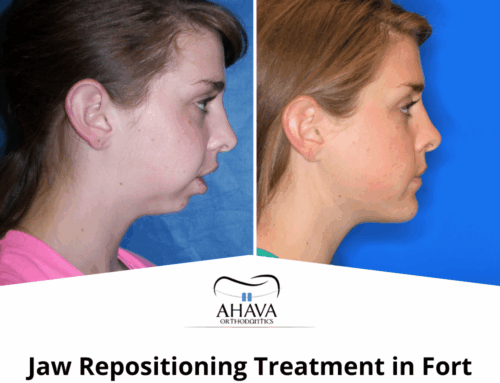 Jaw Repositioning Treatment in Fort Worth: What Parents and Adults Need to Know