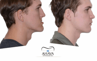 orthognathic surgery roadmap