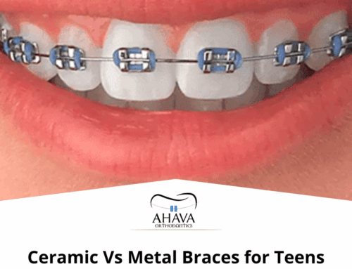 Ceramic vs Metal Braces for Fort Worth Teens