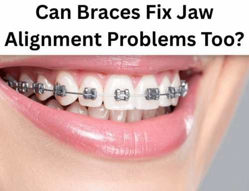 Can Braces Fix Jaw Alignment Problems Too?