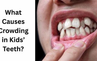 what causes crowding in kids teeth
