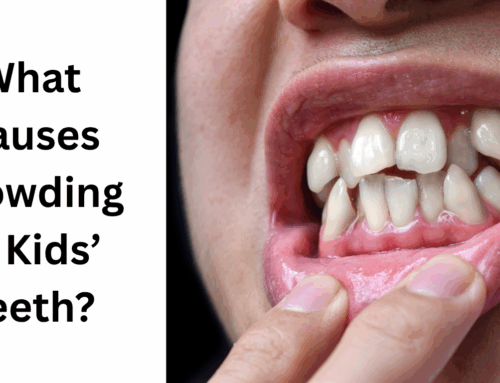 What Causes Crowding in Kids’ Teeth?