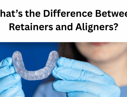 What’s the Difference Between Retainers and Aligners?