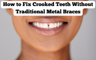 How to Fix Crooked Teeth Without Traditional Metal Braces