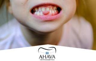 Is It Normal for Kids to Have Gaps in Teeth