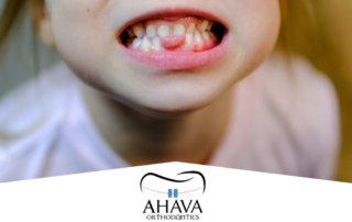 Why Baby Teeth Holders Matter for Adult Teeth