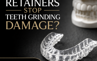 Can Retainers Stop Teeth Grinding Damage